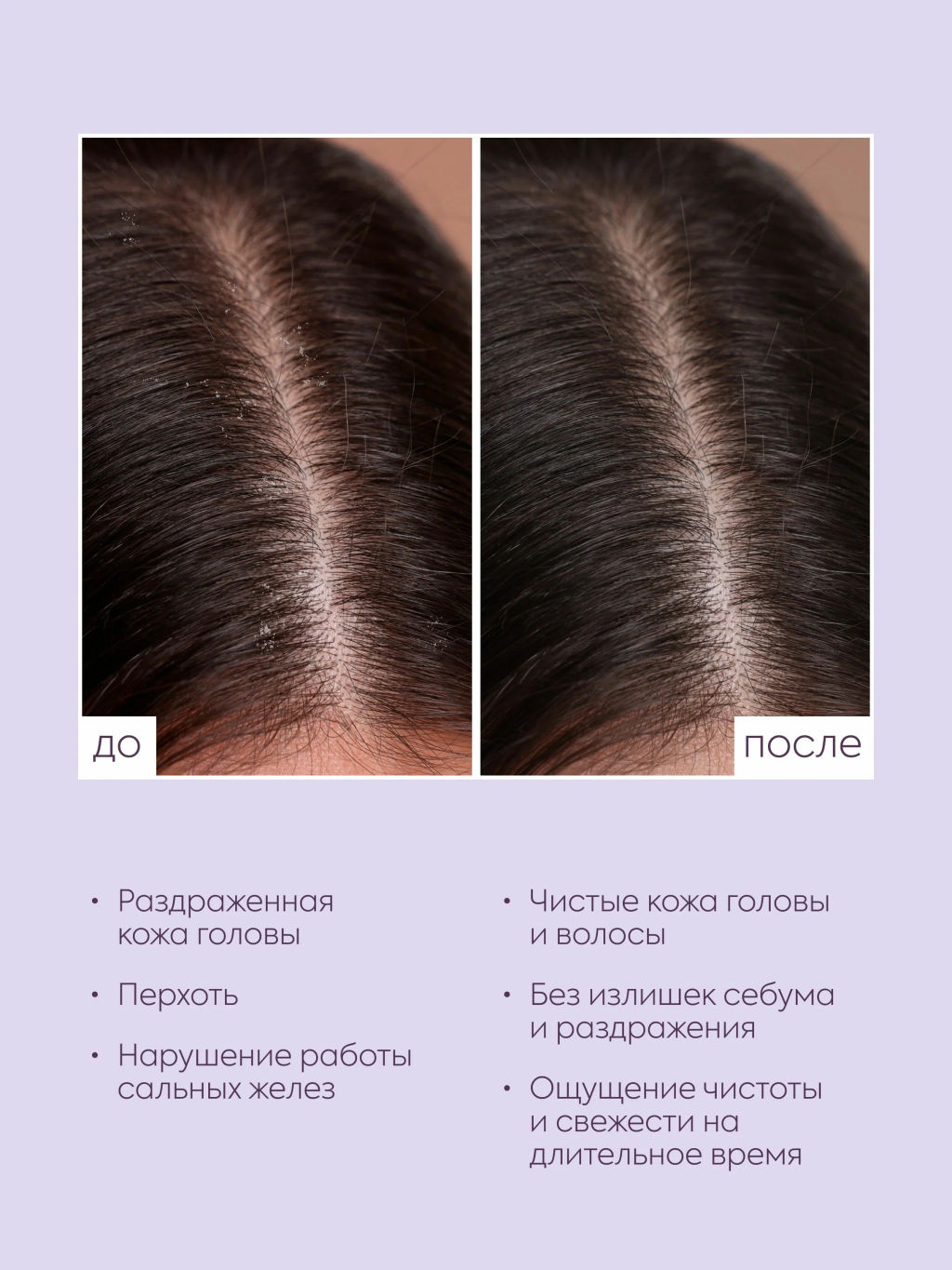 "NS" ICE Professional/ Home/ Anti-dandruff/ Сыворотка Ночная д/борьбы с перхотью 200мл