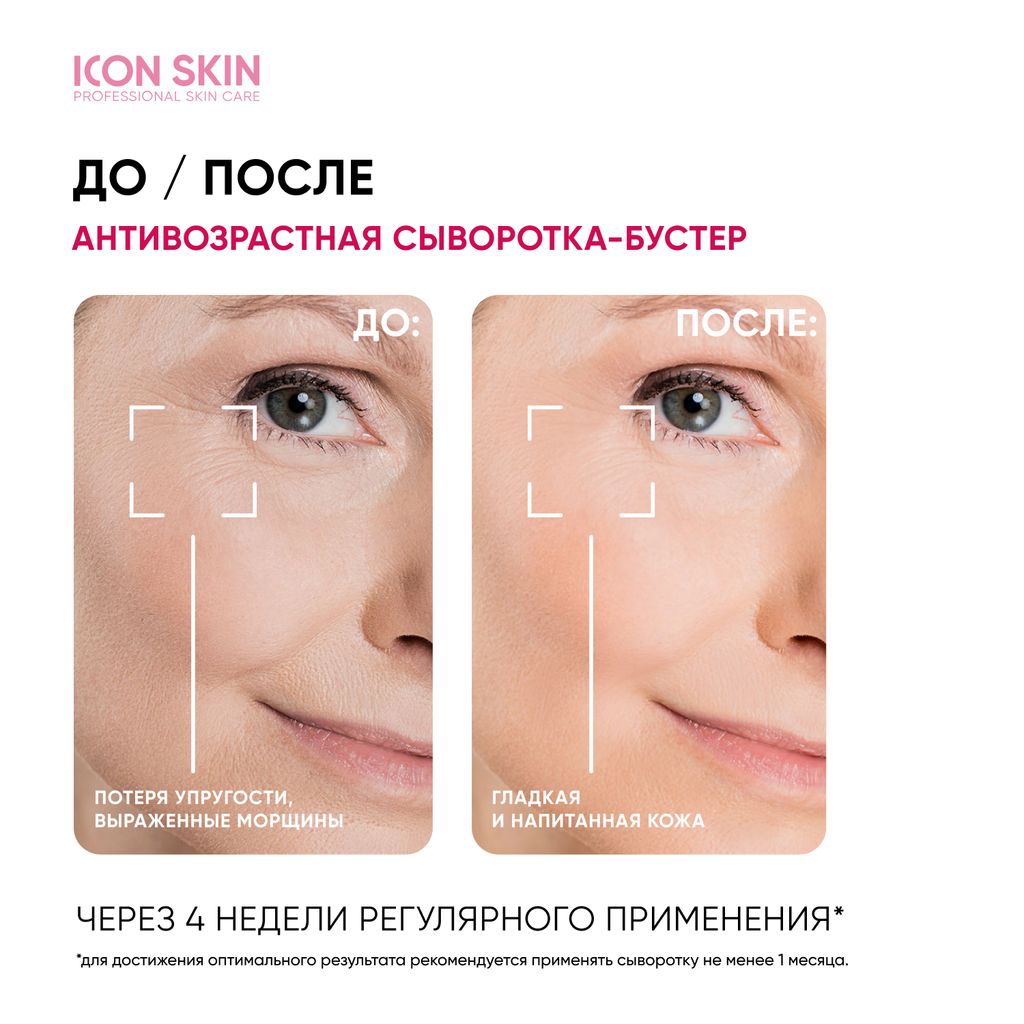 Антивозрастная сыворотка-концентрат Lift Up с коллагеном - Icon skin фото 5
