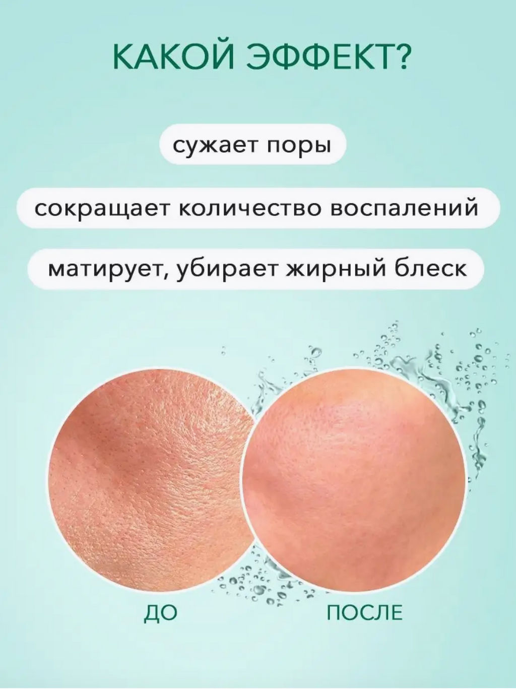 Крем для удаления акне с салициловой кислотой, 30 мл - Bioaqua фото 12