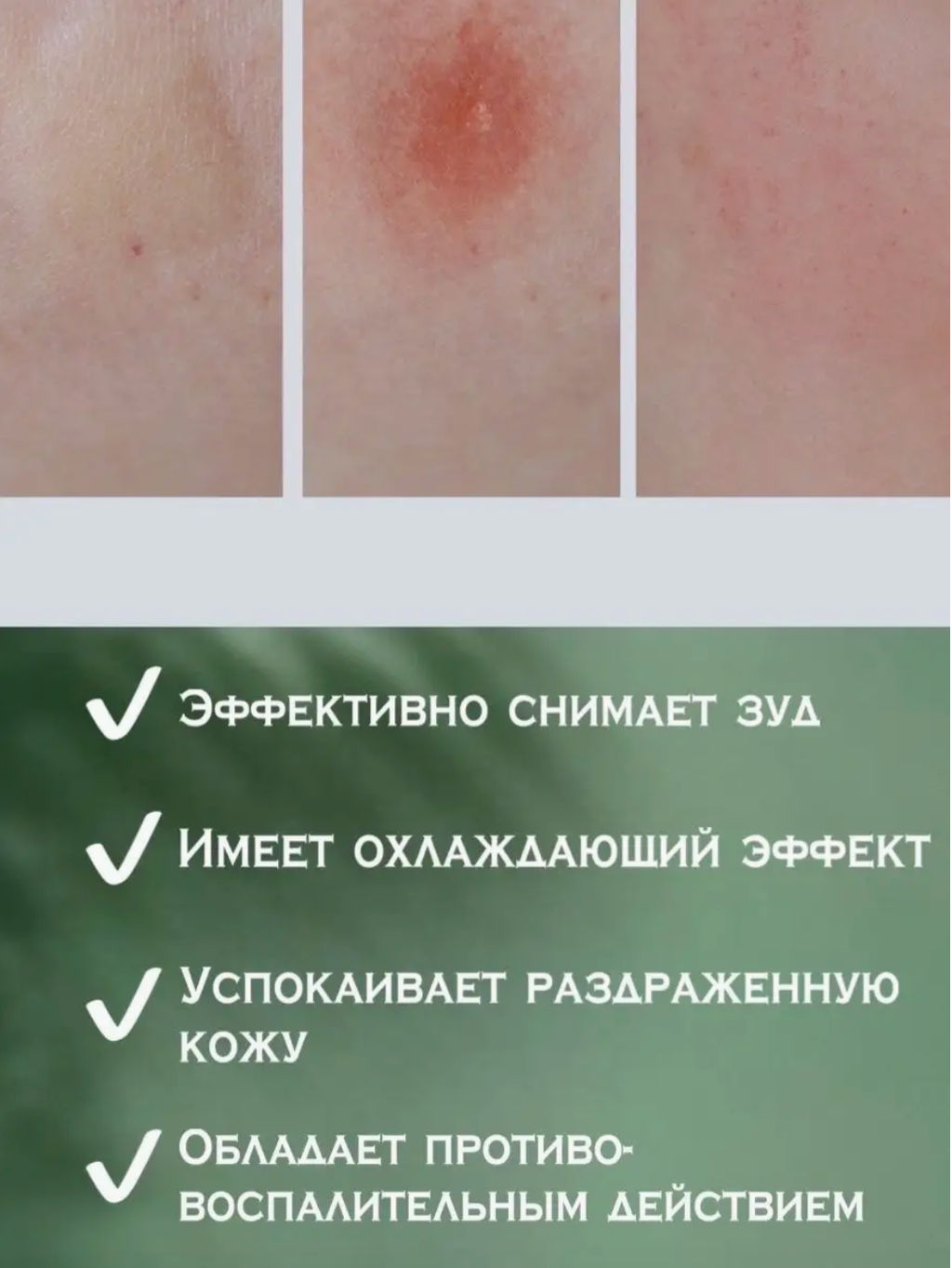 Бальзам после укусов насекомых - Aichun фото 4