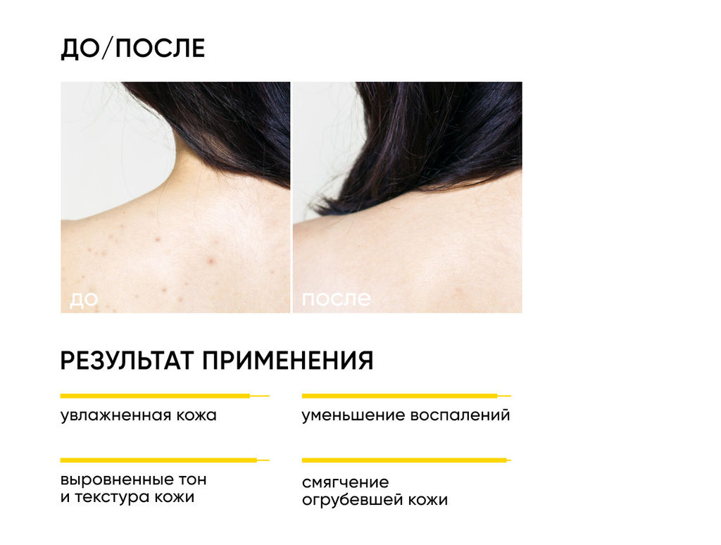 Обновляющий крем для тела с кислотами SKIN RENEWAL, 200 мл ICON SKIN  фото 2