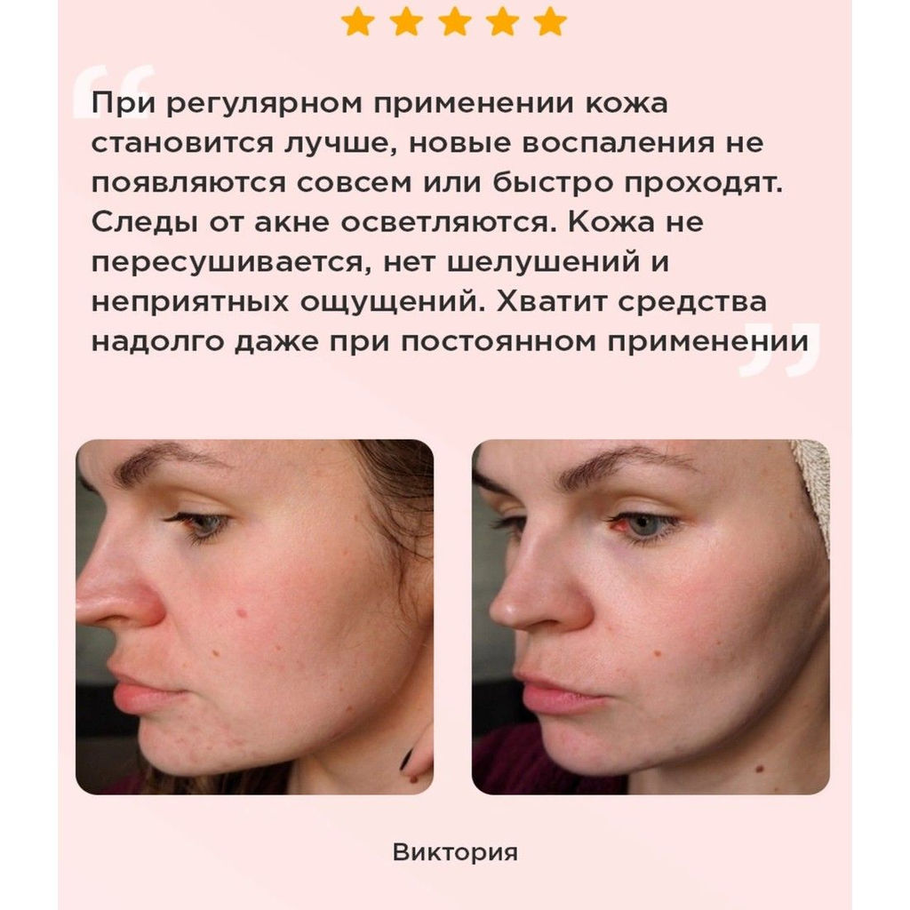 Likato Сыворотка для лица с салициловой кислотой (Sa 2%), 30 мл