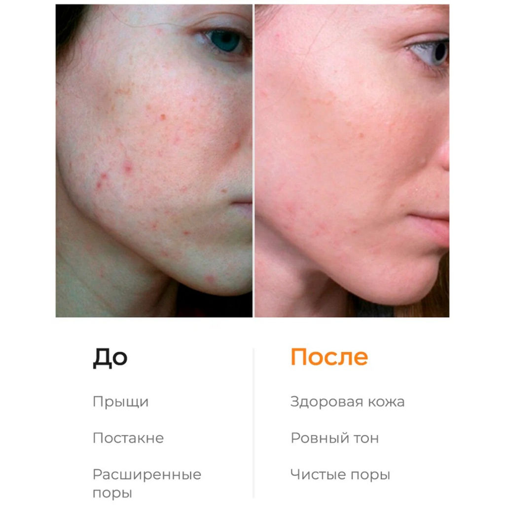 Likato Энзимная пудра для очищения чувствительной кожи и осветления следов постакне, 150 мл  фото 6