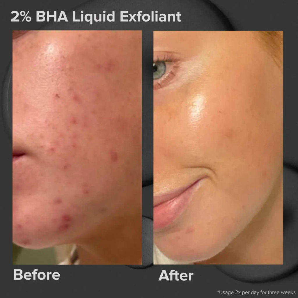 PAULA'S CHOICE Тоник эксфолиант SKIN PERFECTING 2% BHA LIQUID EXFOLIANT 118ml