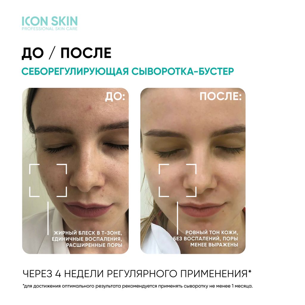 Себорегулирующая сыворотка-концентрат с ниацинамидом Rest Your Sebum - Icon skin фото 14