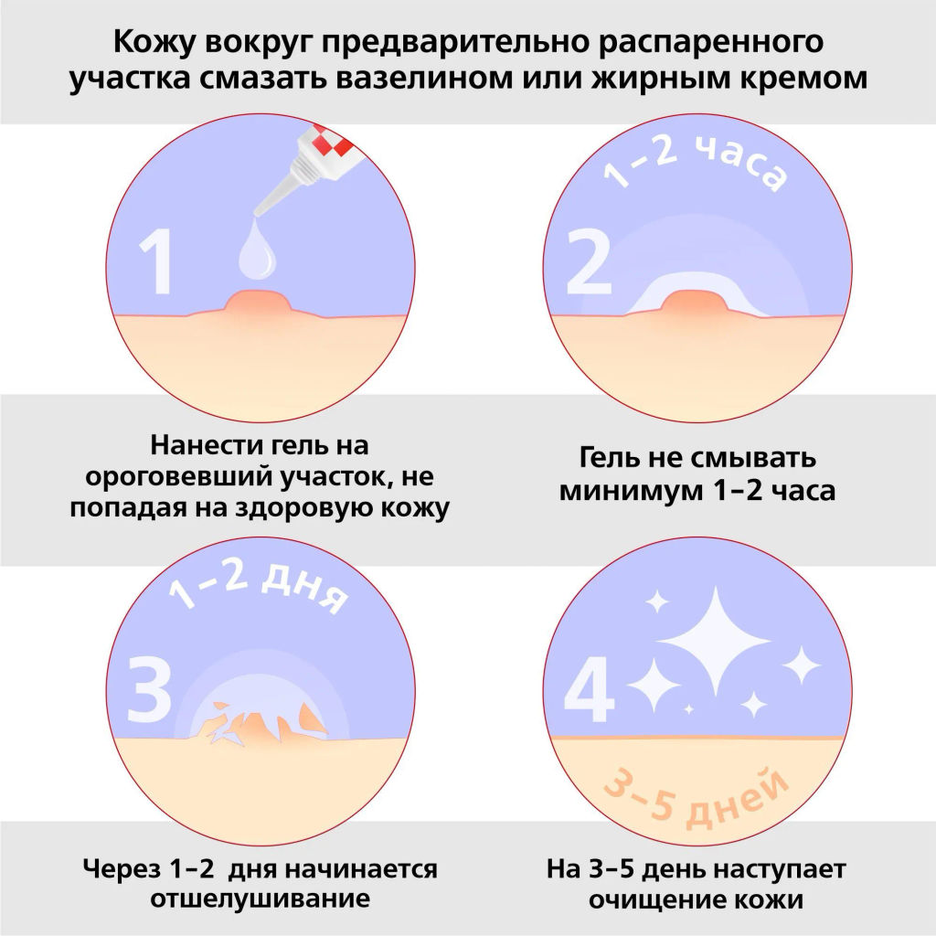 Антипапиллом гель