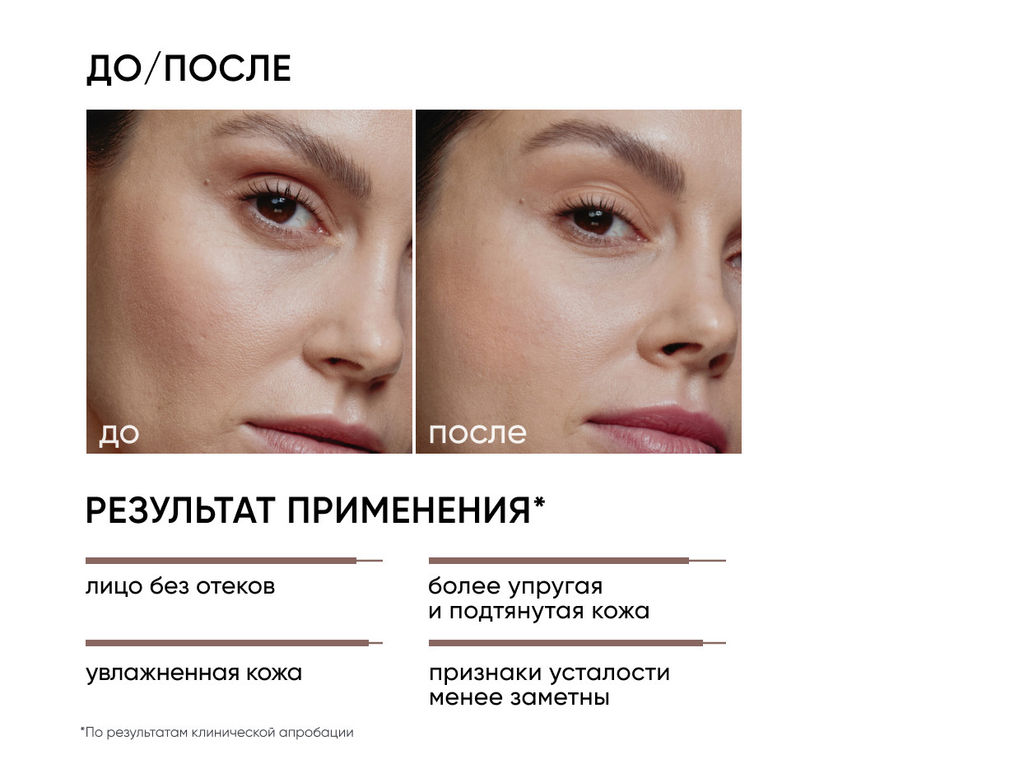 Лимфодренажный тоник Skin Gym ICON SKIN 150 мл  фото 3